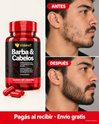 Barba & Cabelos antes y después (imagen ilustrativa)